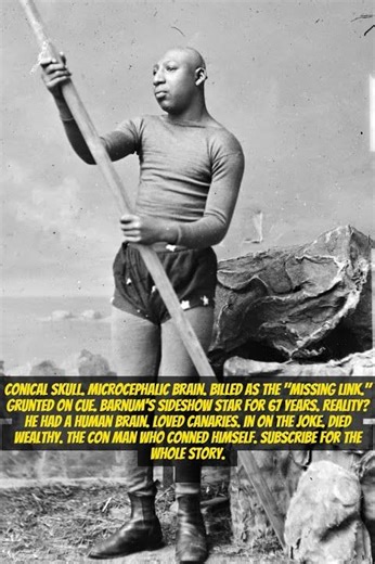 Zip the Pinhead – The Sideshow Hoax Who Outsmarted Everyone