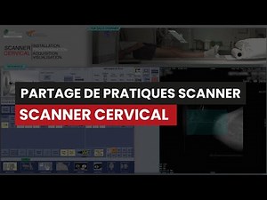 CT Scanner CERVICAL - Partage de pratiques