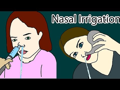 Nasal Irrigation - how to do nasal irrigation. Nasal Rinse