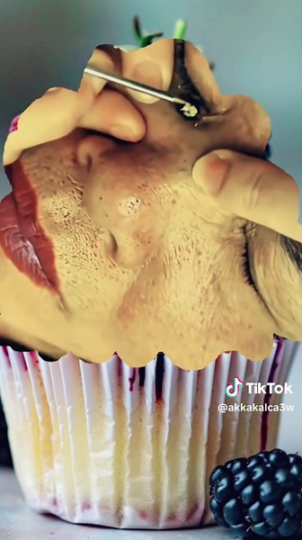 #acnetreatment #acne #acneproneskin | acne