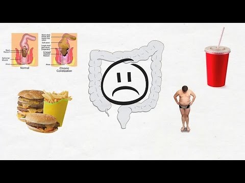 Causes of watery diarrhea