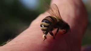 21K views · 93 reactions | Whether you're allergic or not, it's a good idea to know how to treat bee stings. First aid steps to follow: | WebMD | Facebook