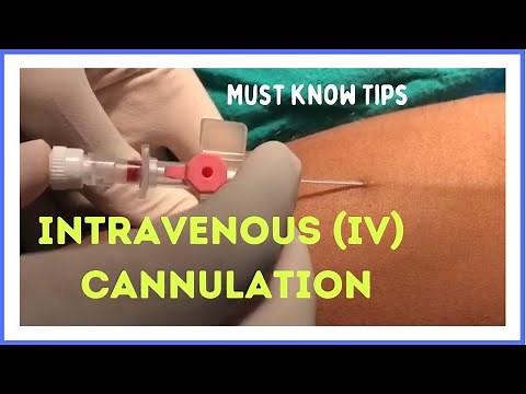 INTRAVENOUS (I.V) CANNULATION (in 5 mins)| How to insert
