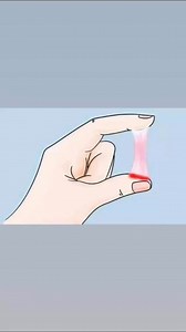 18K views · 86 reactions | Vaginal discharge is a clear or whitish fluid that comes out of your vagina. Discharge is normal, but changes in the amount, consistency, color or smell could indicate an infection or other problem. | Med G | Facebook