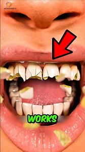 If You Bite Ice Then Drink Hot Coffee... This Is What Really Happens to Your Teeth!