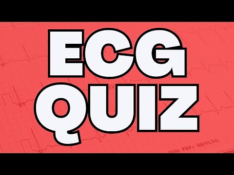 ECG Quiz Collection