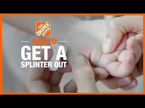 How to Get a Splinter Out | The Home Depot