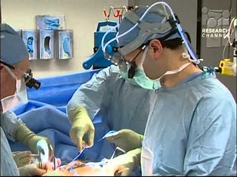 Breast Reconstruction - UW Medicine