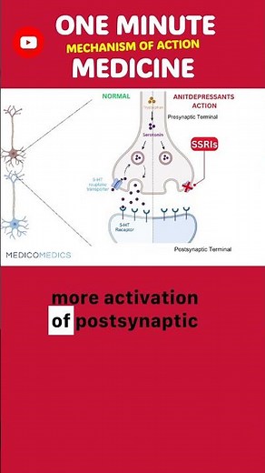Here’s How SSRIs Work — Step by Step 🧠💬💊