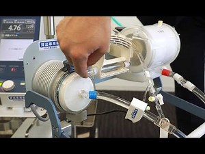 体外式膜型人工肺（ＥＣＭＯ、エクモ）