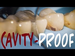 How to Keep a Cavity from Getting Worse