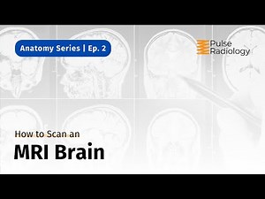 How to Scan an MRI Brain