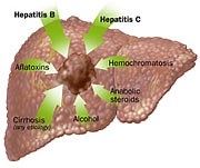 Liver Cancer (Hepatocellular Carcinoma)
