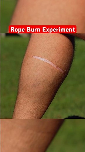 Insanely Painful ROPE BURN Experiment… #funny #science #comedy