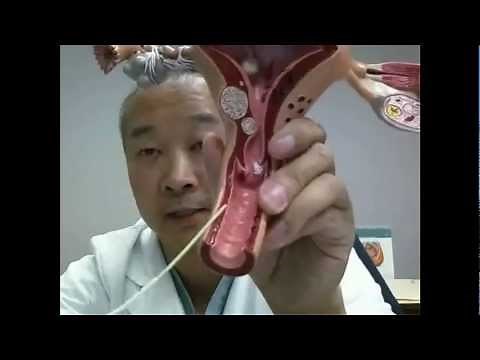 How to get pregnant?