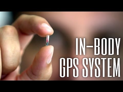 Why an in-body GPS tracker is really useful | ReMix in-body GPS microchip