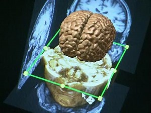 Program Three: Brain Matters ~ Video: Full Episode | The Human Spark | PBS