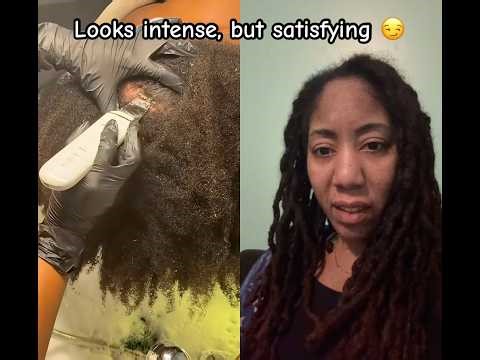 Scalp treatment #dandruff #scalptreatment #naturalhair #haircare #healthyhair #scalpdetox