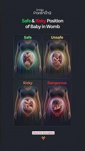 Baby Positions in Pregnancy | Safe vs Unsafe Fetal Positions #pregnancytips #babyshorts #pregnant