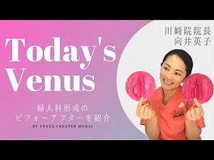 【Today's Venus】婦人科形成 施術動画付き解説♪