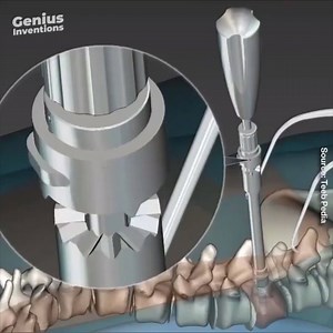 448K views · 865 reactions | Fixing a curved Spine | Doctor Lisa | Facebook
