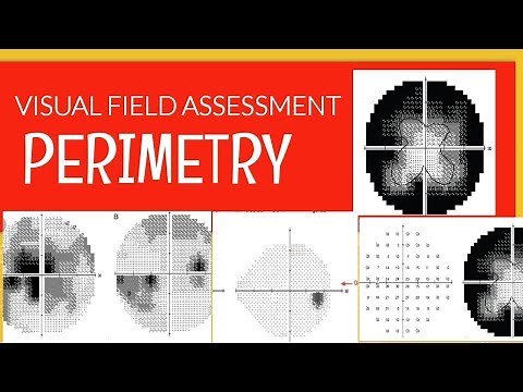 PERIMETRY|| How to read a visual field printout?