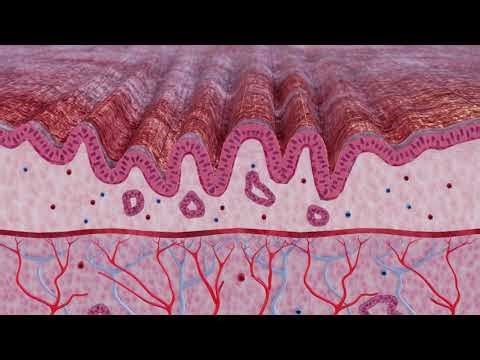 C2 CryoBalloon Ablation System - Product and Technology Overview