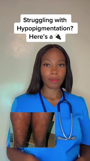 Effective Solutions for Hypopigmentation on Skin