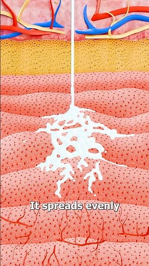 How Needle-Free Injections Actually Work 🤔 Surgeon Reacts