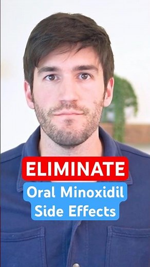 4 Ways to ELIMINATE Oral Minoxidil Side Effects