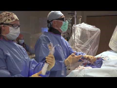 What is a Cardiac Cath Lab? Dr. John Pap, UP Health System - Marquette