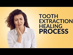 Tooth Extraction Healing Process: 10 Tips For Fast Recovery