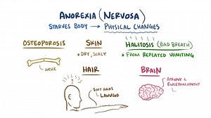 Video: Anorexia nervosa - Video Explanation! | Osmosis | Osmosis