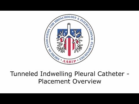 Tunneled Indwelling Pleural Catheter-Placement Overview