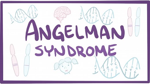 Angelman syndrome: Video, Causes, & Meaning | Osmosis