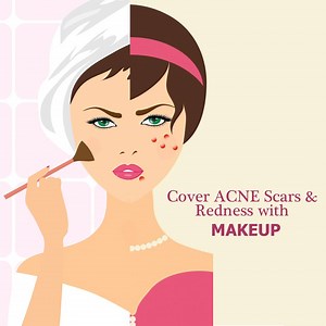 510K views · 868 reactions | You don't need to worry about acne redness and scarring ever again! Our makeup expert will guide you through some quick tips and tricks to cover all of this and get absolutely flawless skin!! | Glamrs | Facebook