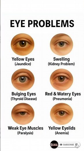 Top 06 Eye Problems You Should Never Ignore