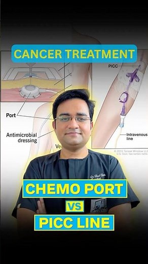 Chemo Port vs PICC Line | Cancer Treatment Devices Simplified