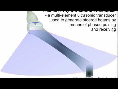 Phased-Array Ultrasonic Transducer - Principle of Operation ANIMATION