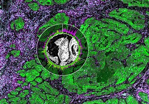 Why Spatial Biology Enhances Spatial Transcriptomics Data