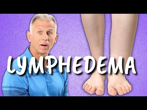 10 Exercises for Leg Lymphedema (Swelling or Edema of the Lower Extremities)