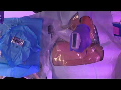 Ultrasound Guided Central Line Placement STEP BY STEP