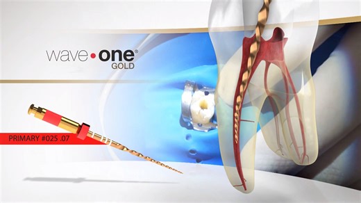 Introducing WAVEONE® GOLD - the latest generation of reciprocating file technology, developed in collaboration with four endodontic key opinion leaders (Drs. Kuttler, Pertot, Ruddle & Webber). WAVEONE GOLD, as the successor of WAVEONE, keeps the same philosophy of simplicity as the first generation that was launched in 2011, with strong additional benefits that enhance the confidence level of dentists. | Dentsply Sirona | Facebook