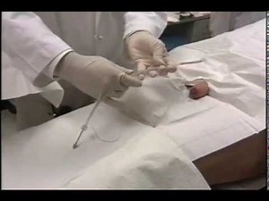 Spanner Insertion Procedure