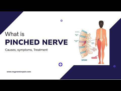 Best Treatment for Pinched Nerve in Lower Back Pain