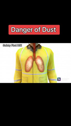 Understanding the Dangers of Dust Exposure at Work