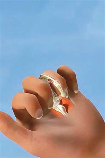 Ever wondered how Trigger Finger Surgery is done? 👇Trigger Finger Release Surgery helps fix a finger that locks or clicks due to a tight tendon sheath. Watch how surgeons carefully release the trapped tendon and restore smooth movement. #SurgeryVideo #TriggerFingerRelease #MedicalAnimation #TriggerFinger #TriggerFingerSurgery