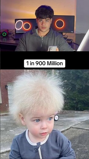 The Rarest Human Genes Ever Discovered 😳