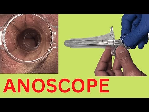 How Does an ANOSCOPE Work?