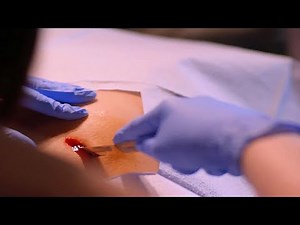 Stargate Universe - Remote Surgery